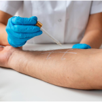 From Chronic Vein Issues to Natural Healing: Combining Ablation with Regenerative Therapies